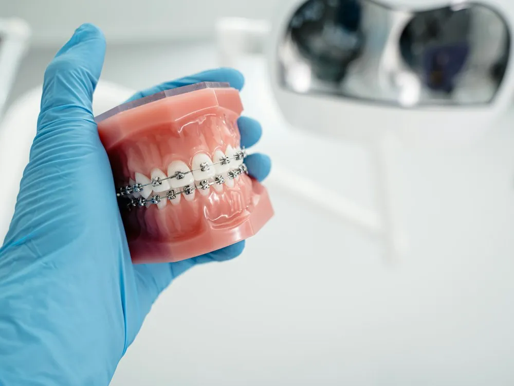Dental model fitted with braces