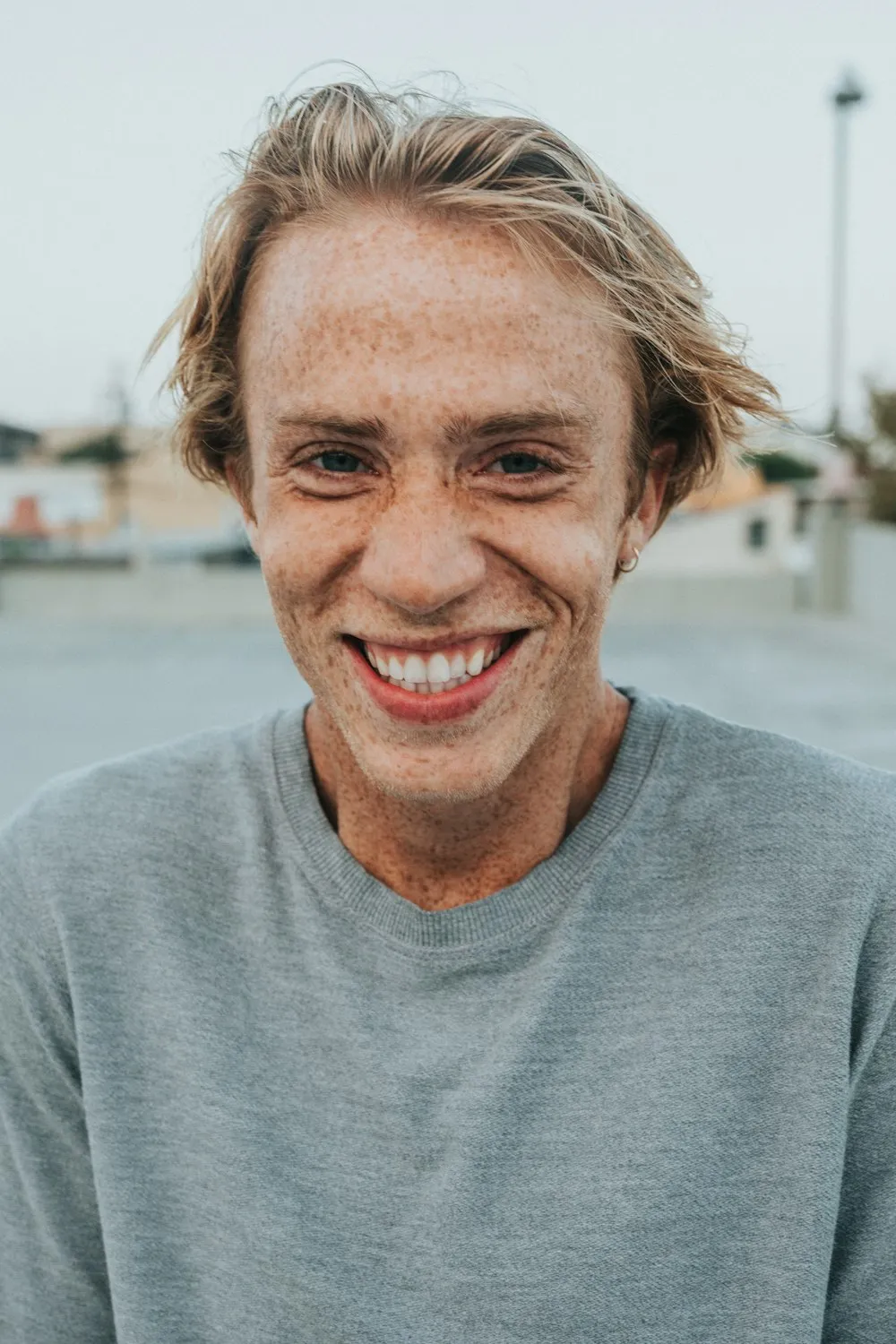 James O., Dental Implant patient